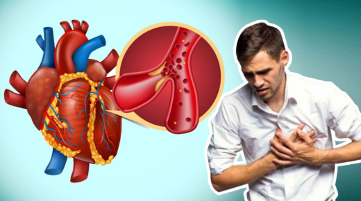 Navigating the Differences Between Angina and Myocardial Infarction on Quizlet