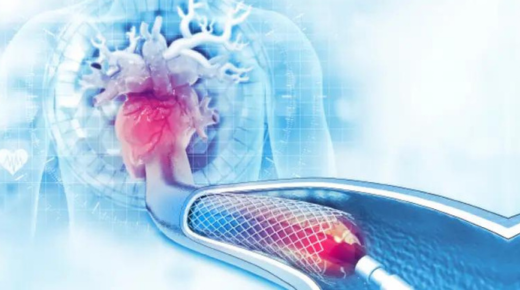 Travel Insurance with Angina - Everything You Need to Know