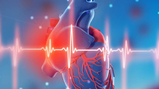 Understanding the CCS Classification for Angina